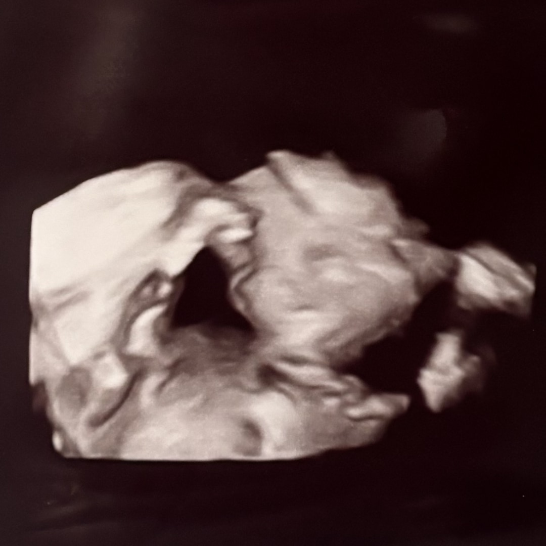 Photo shared by Aubrey for their Babylist baby registry.