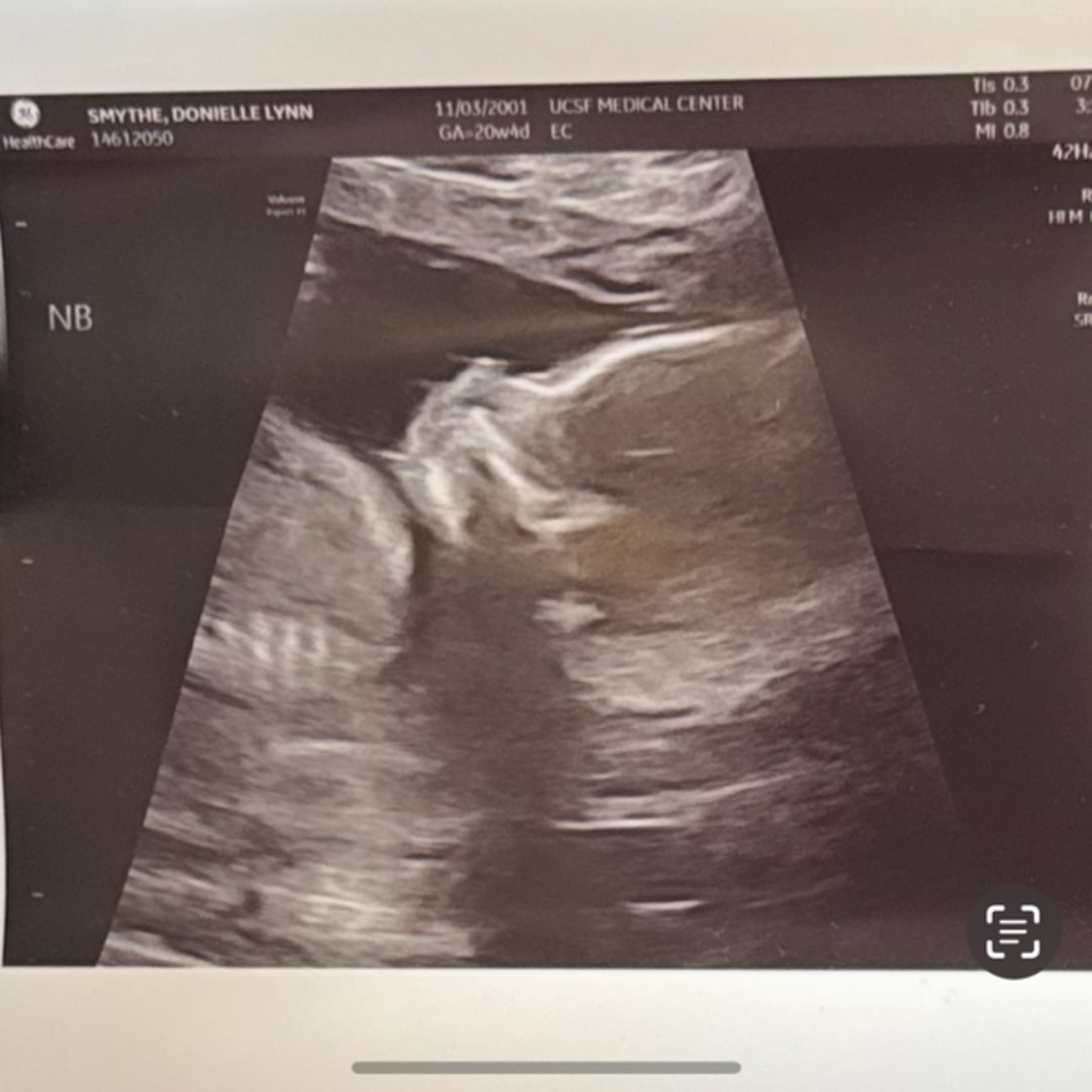 Photo shared by Donielle for their Babylist baby registry.