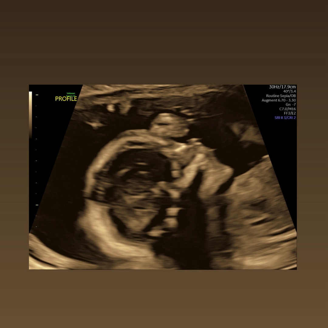 Photo shared by Cambrya for their Babylist baby registry.