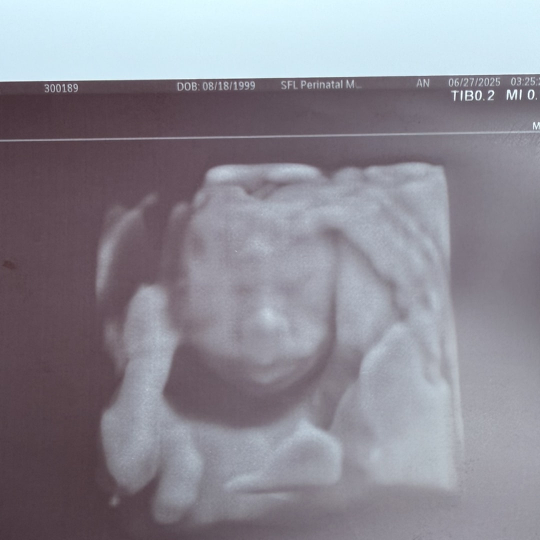 Photo shared by Erika for their Babylist baby registry.