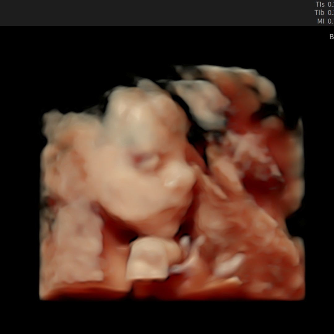 Photo shared by Madison for their Babylist baby registry.