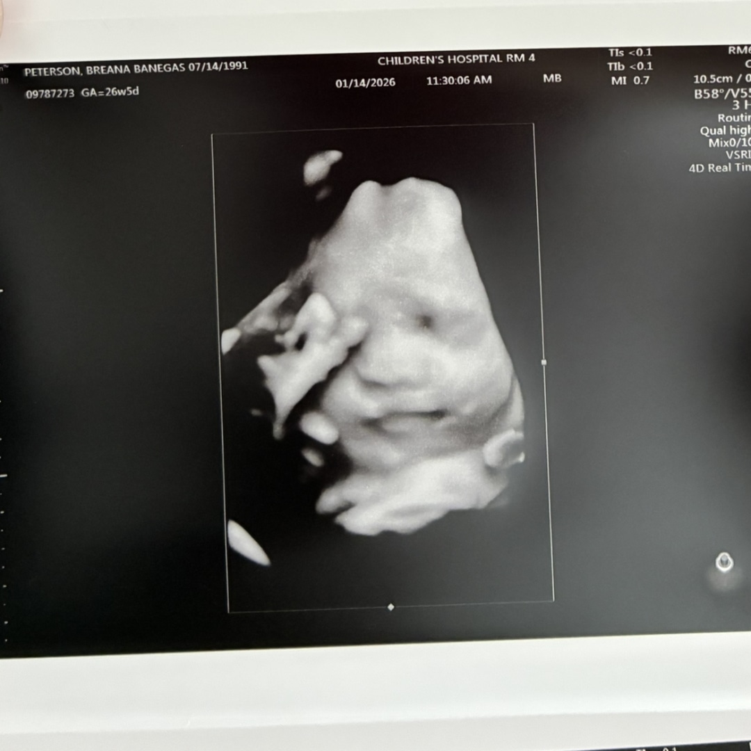 Photo shared by Breana for their Babylist baby registry.