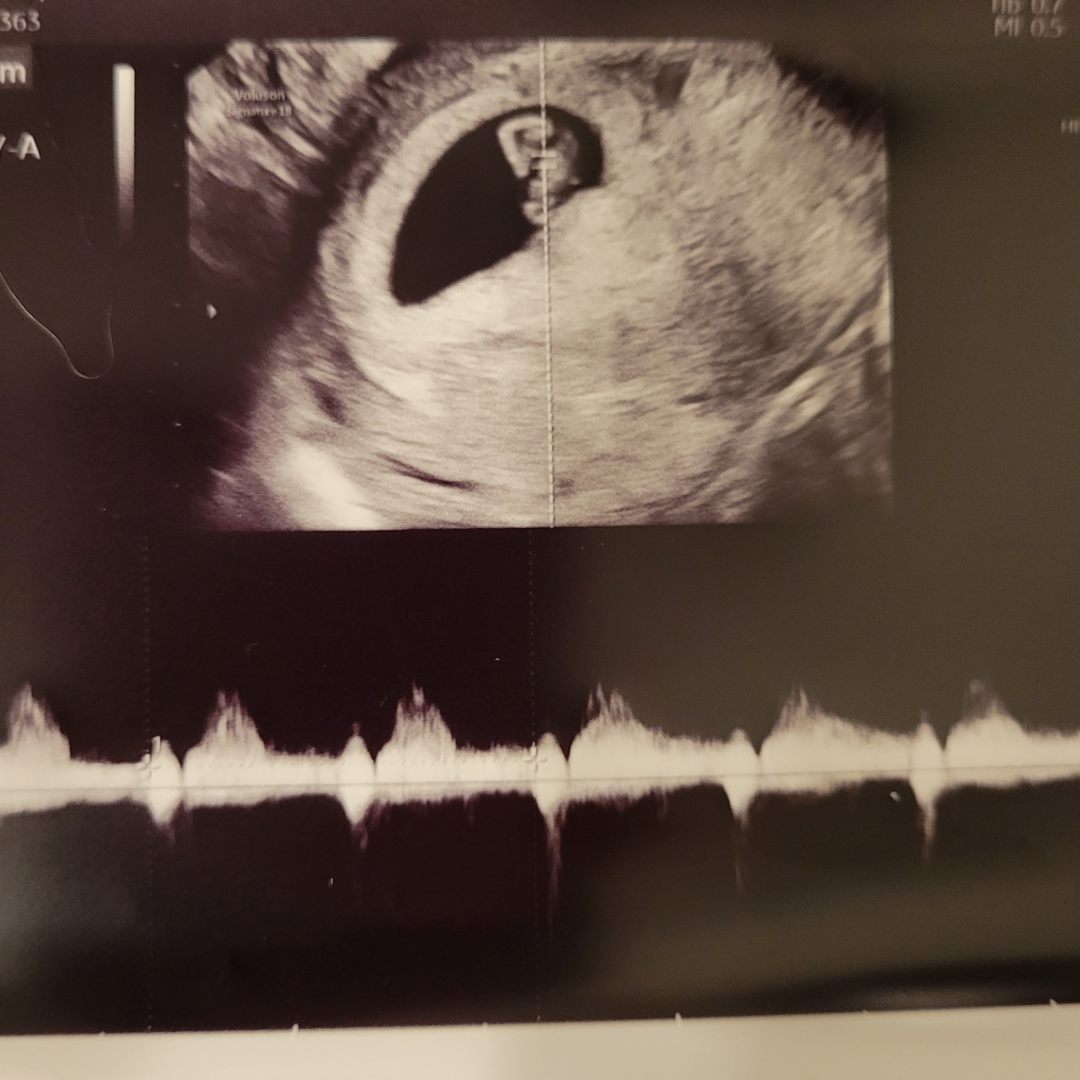 Photo shared by Savannah & Darren for their Babylist baby registry.