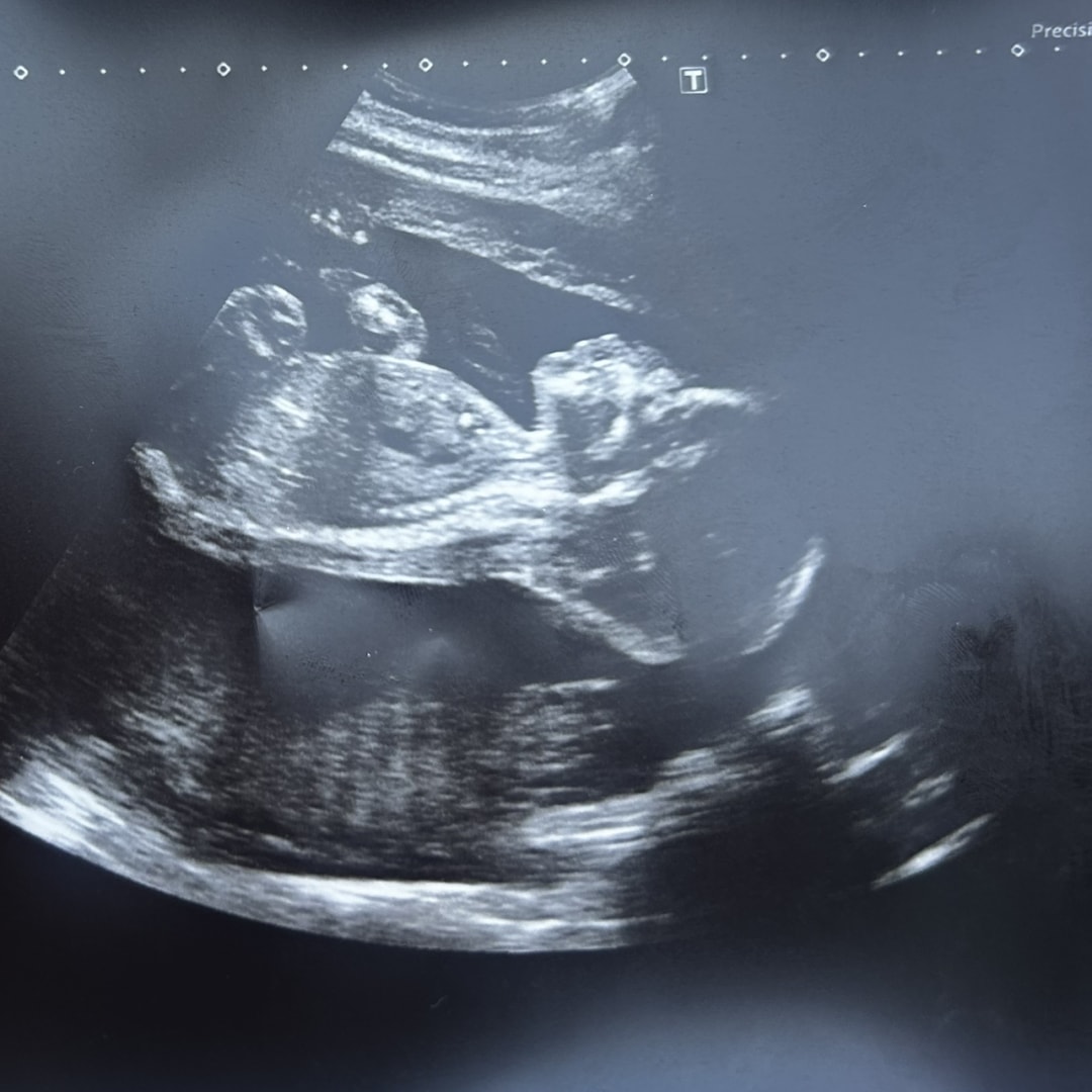 Photo shared by Elvira and Jonathan for their Babylist baby registry.