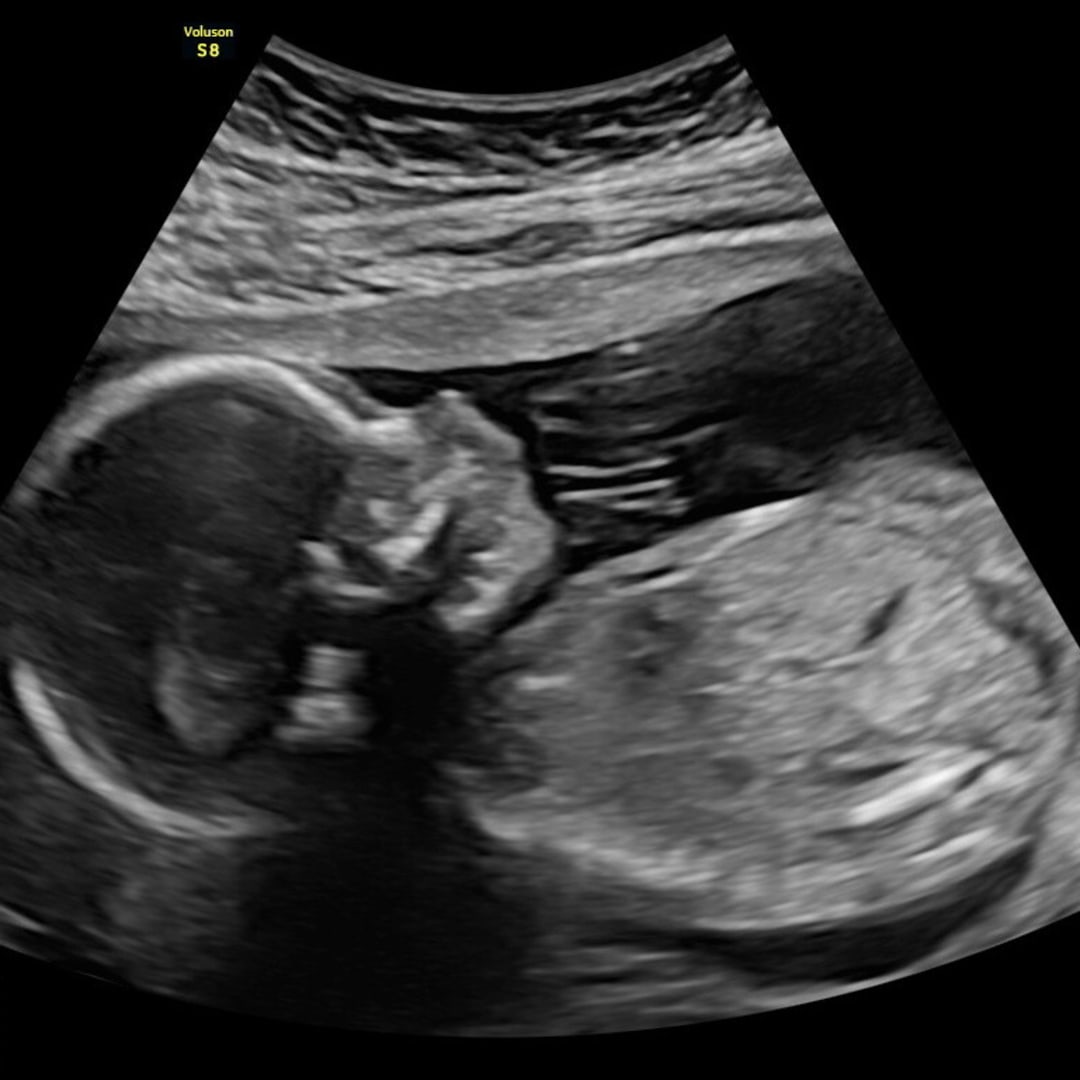 Photo shared by Rachel for their Babylist baby registry.