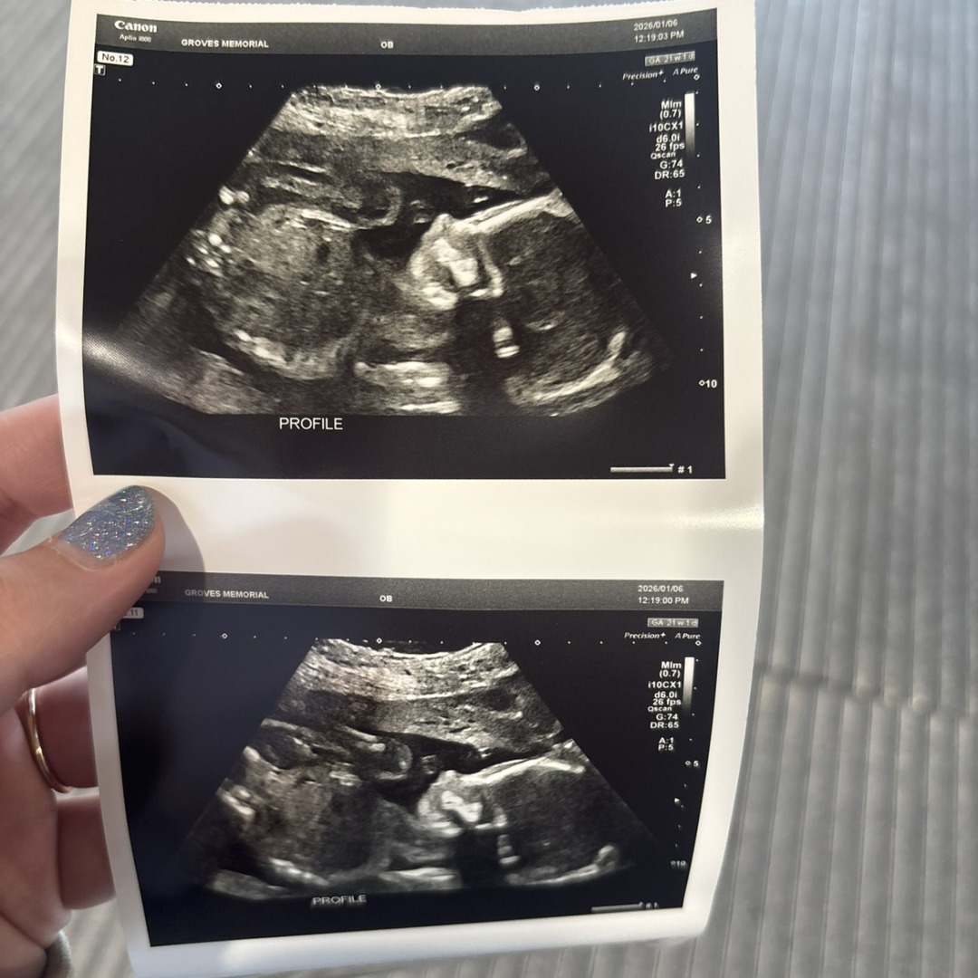 Photo shared by Lauren for their Babylist baby registry.