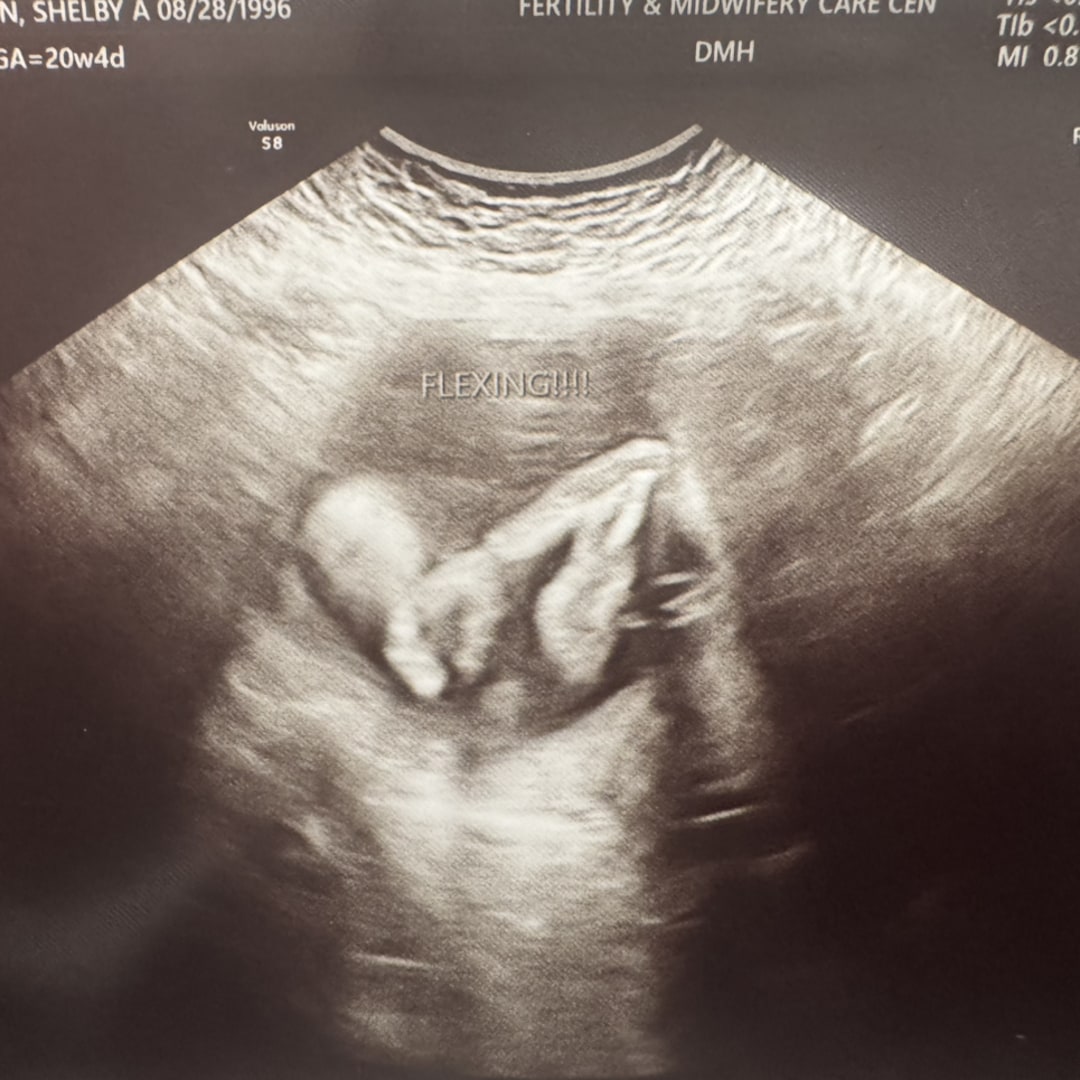 Photo shared by Shelby for their Babylist baby registry.