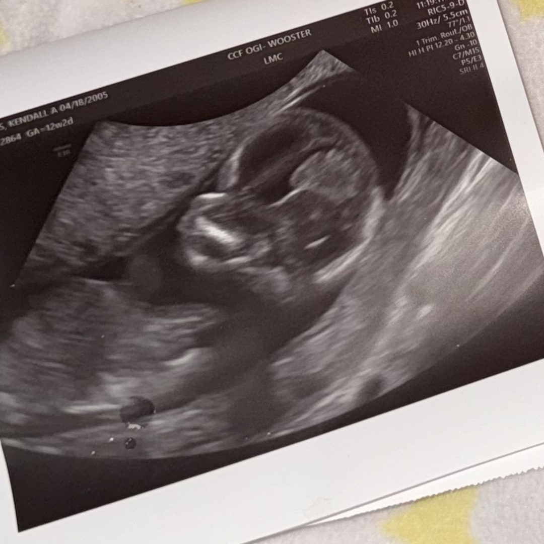 Photo shared by Kendall for their Babylist baby registry.