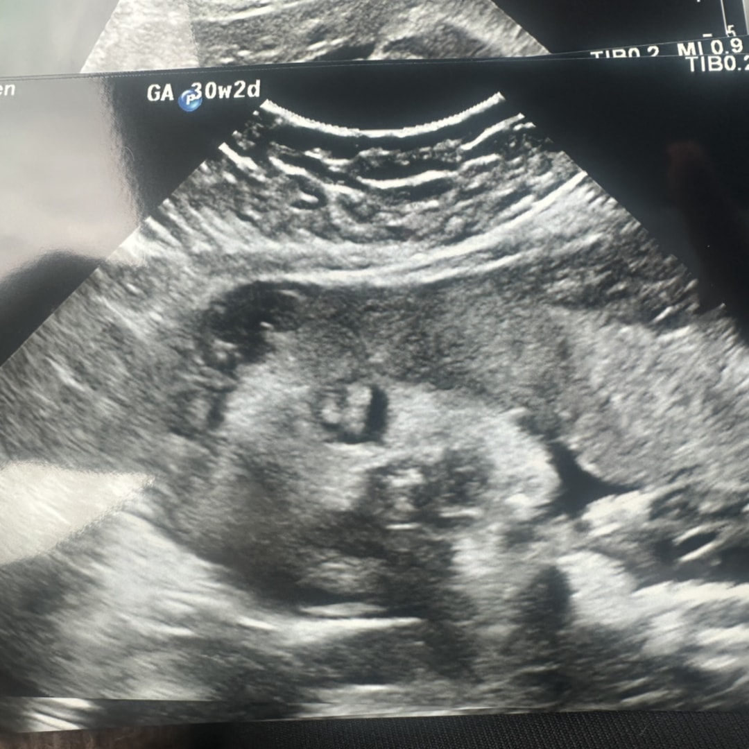 Photo shared by Acora for their Babylist baby registry.