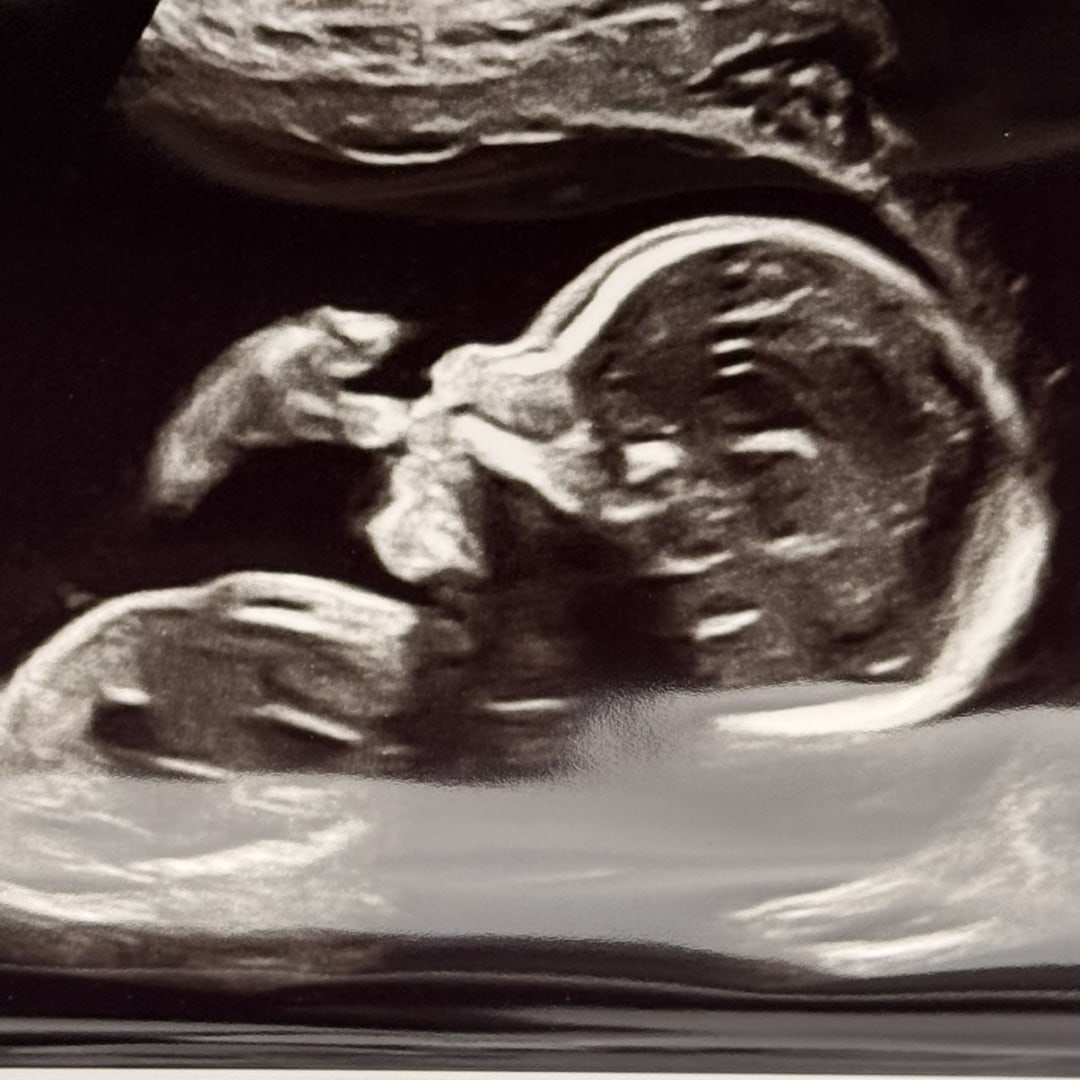 Photo shared by Elissa for their Babylist baby registry.
