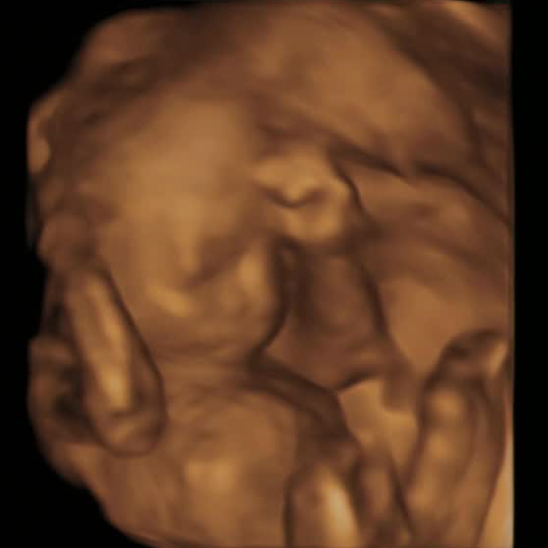 Photo shared by McKenna for their Babylist baby registry.