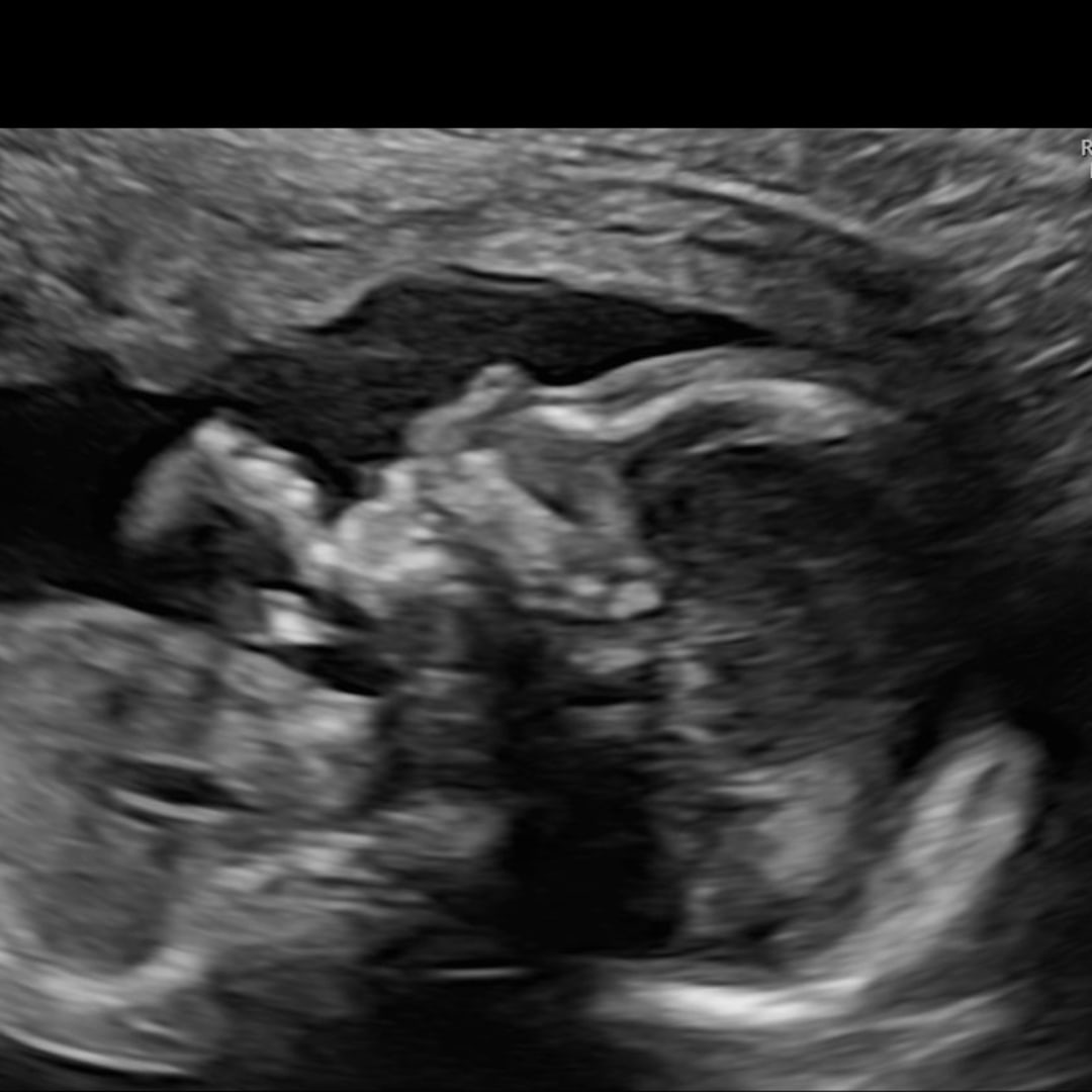 Photo shared by Kerin for their Babylist baby registry.