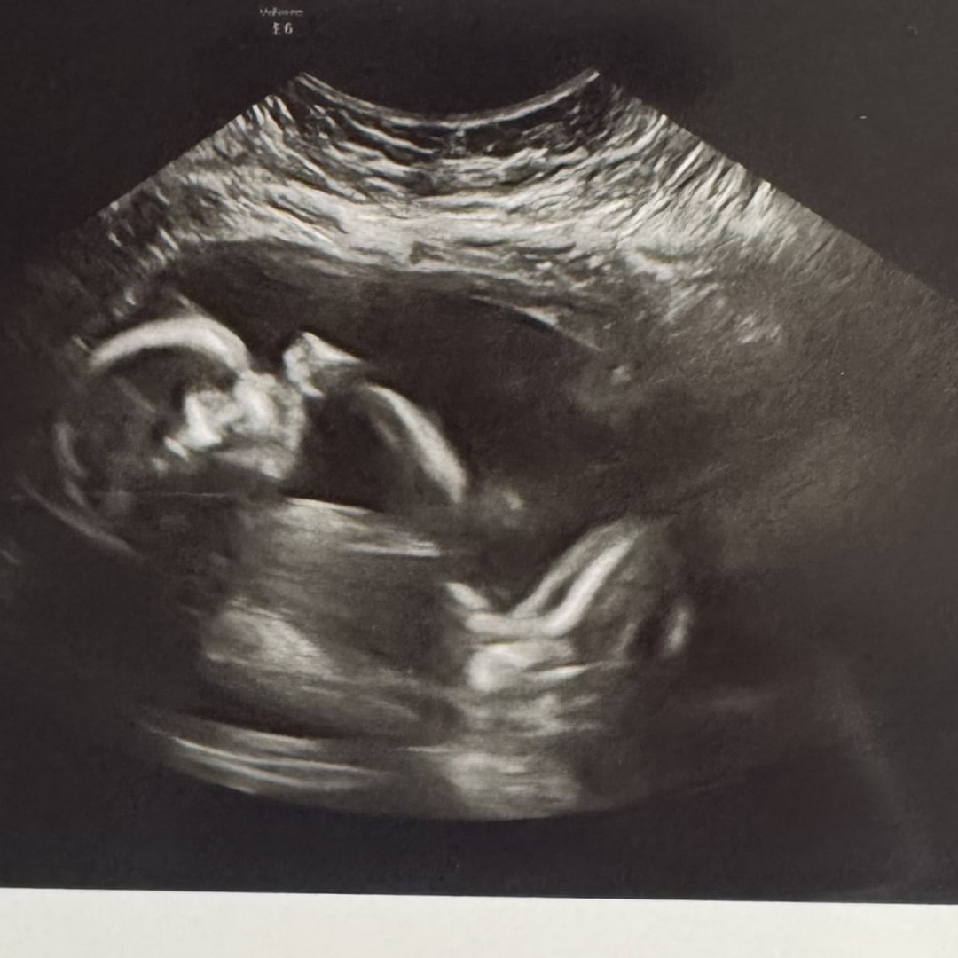 Photo shared by Alyssa for their Babylist baby registry.