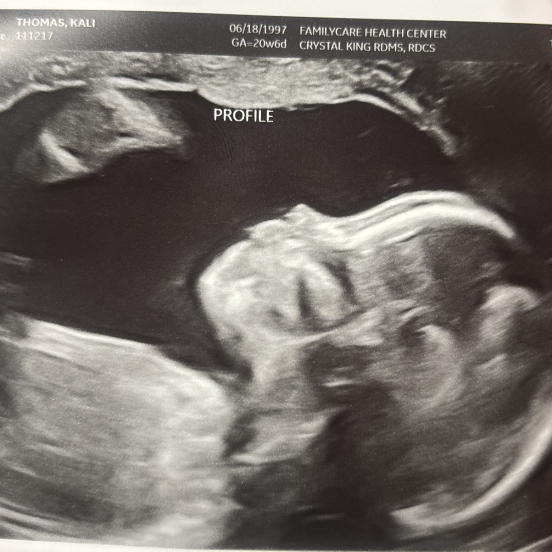 Photo shared by Kali for their Babylist baby registry.