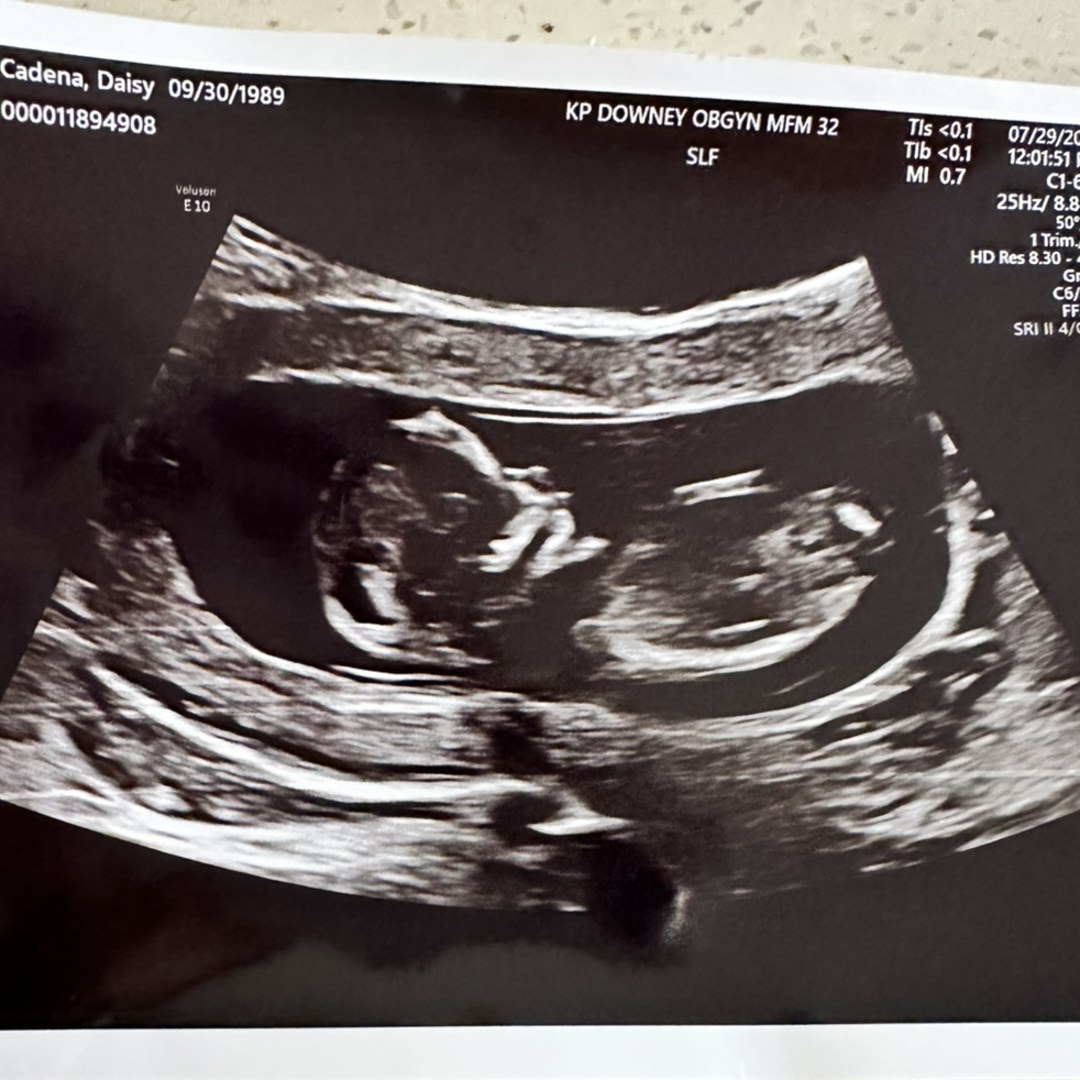 Photo shared by Daisy for their Babylist baby registry.