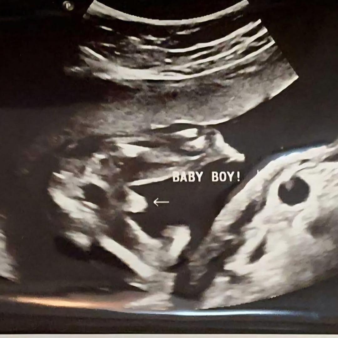 Photo shared by Baby Boy for their Babylist baby registry.