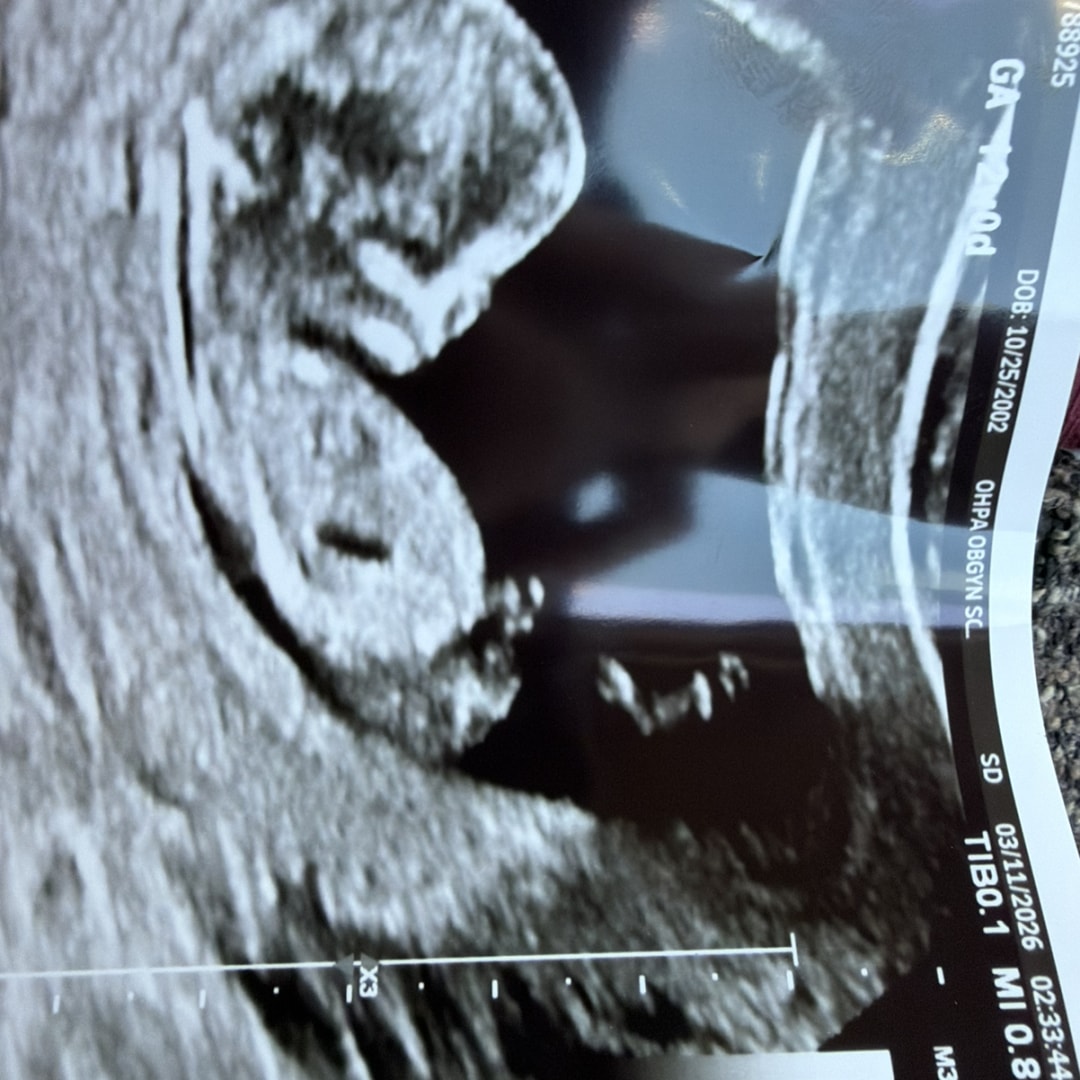 Photo shared by Alexis for their Babylist baby registry.