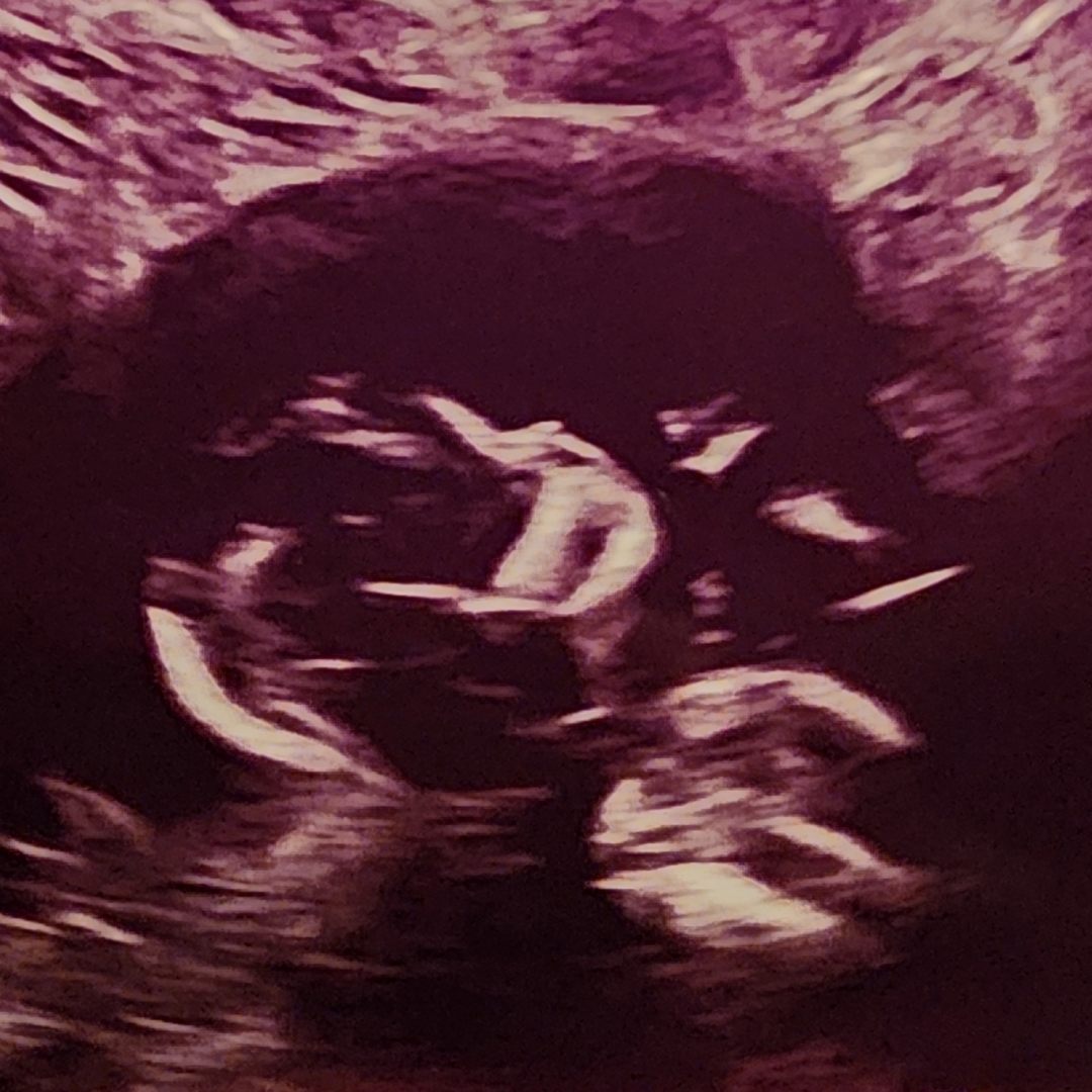 Photo shared by Seng for their Babylist baby registry.