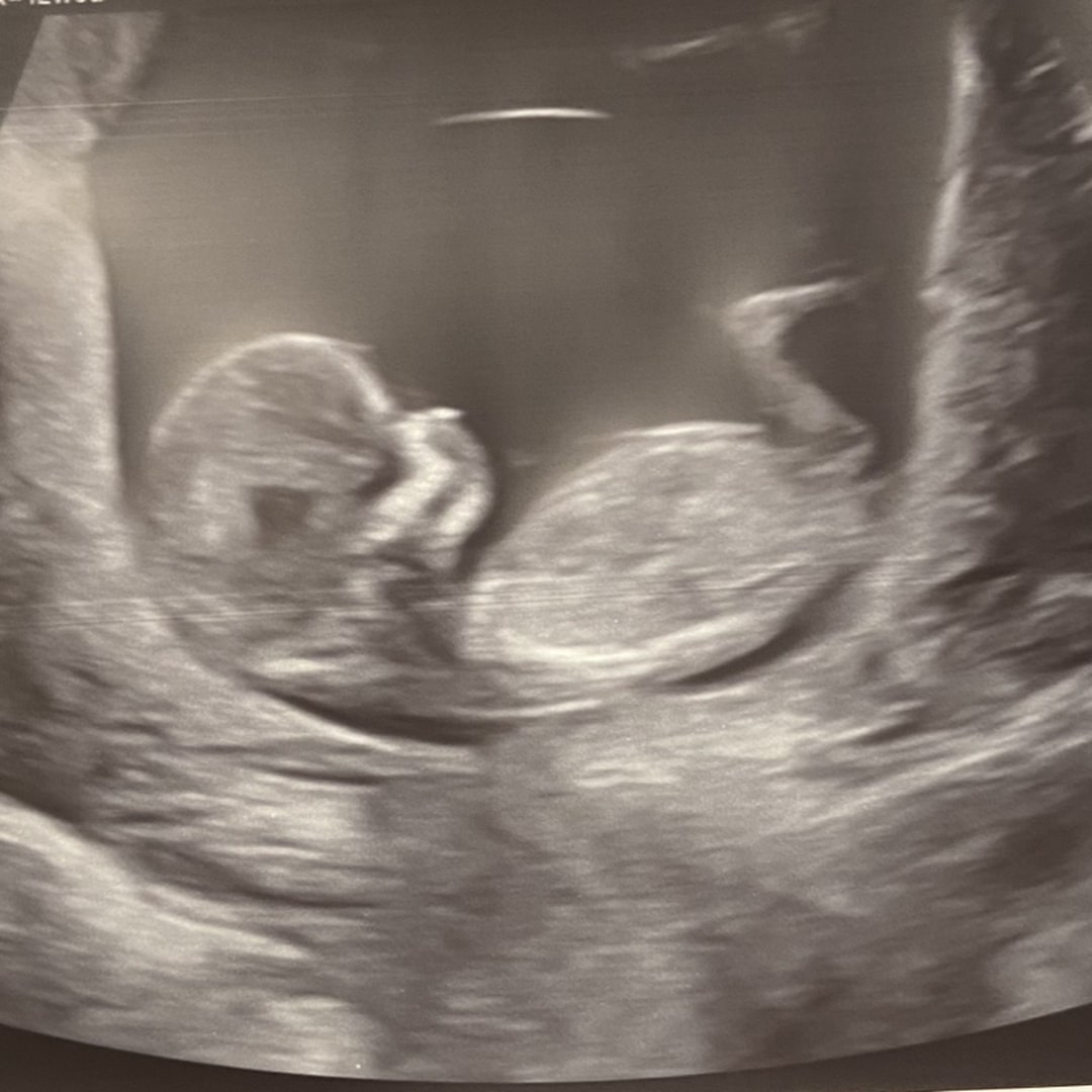 Photo shared by Erin for their Babylist baby registry.