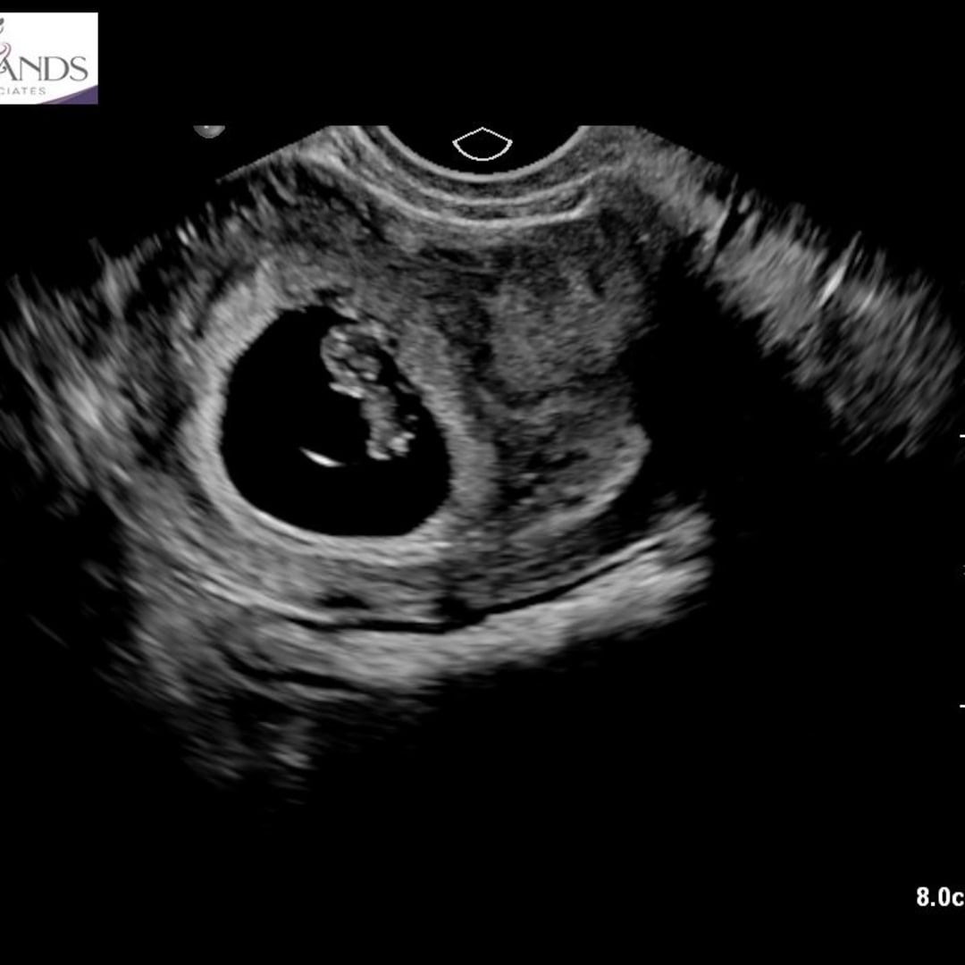 Photo shared by Allie for their Babylist baby registry.