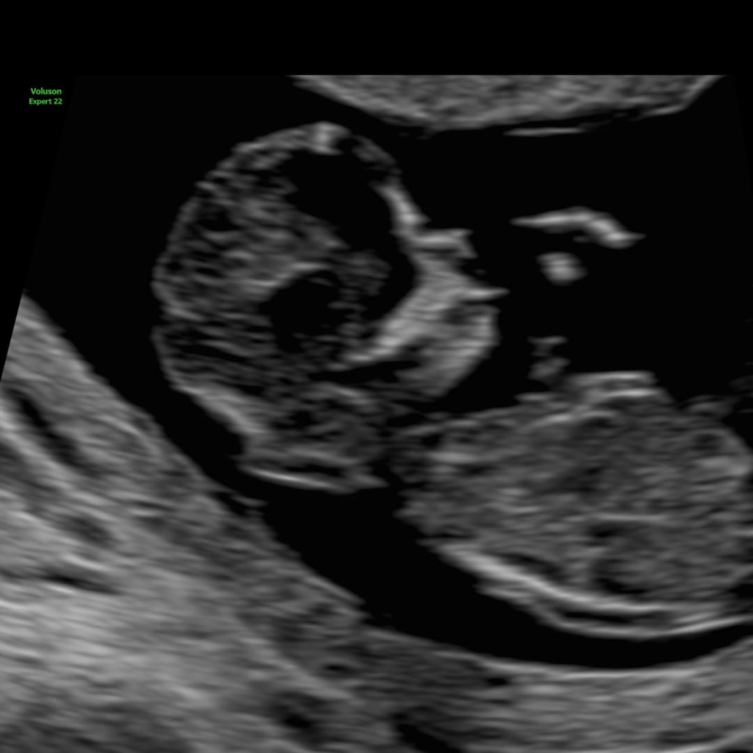 Photo shared by Hayle for their Babylist baby registry.