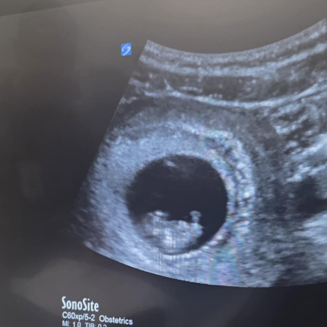 Photo shared by Akita for their Babylist baby registry.