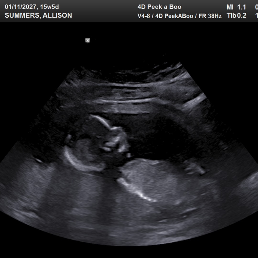 Photo shared by Allison for their Babylist baby registry.