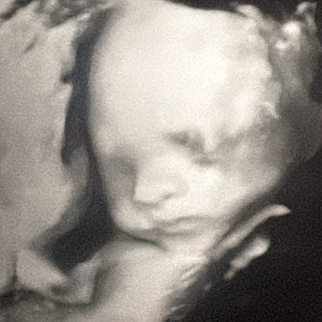 Photo shared by Caidence for their Babylist baby registry.