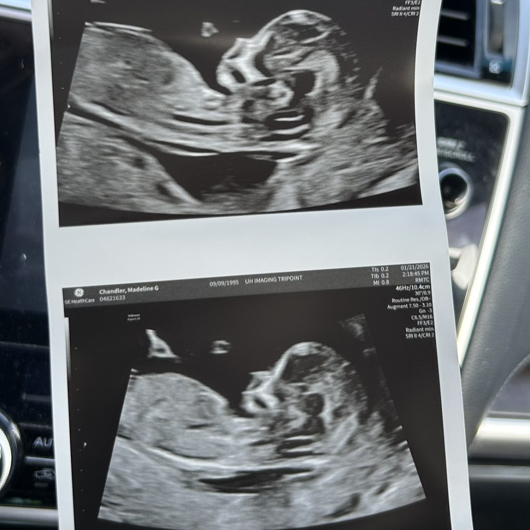 Photo shared by Maddie for their Babylist baby registry.