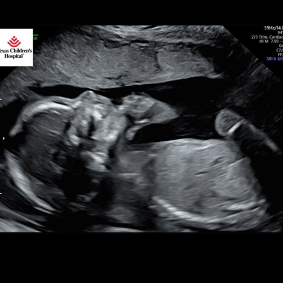 Photo shared by Samantha for their Babylist baby registry.