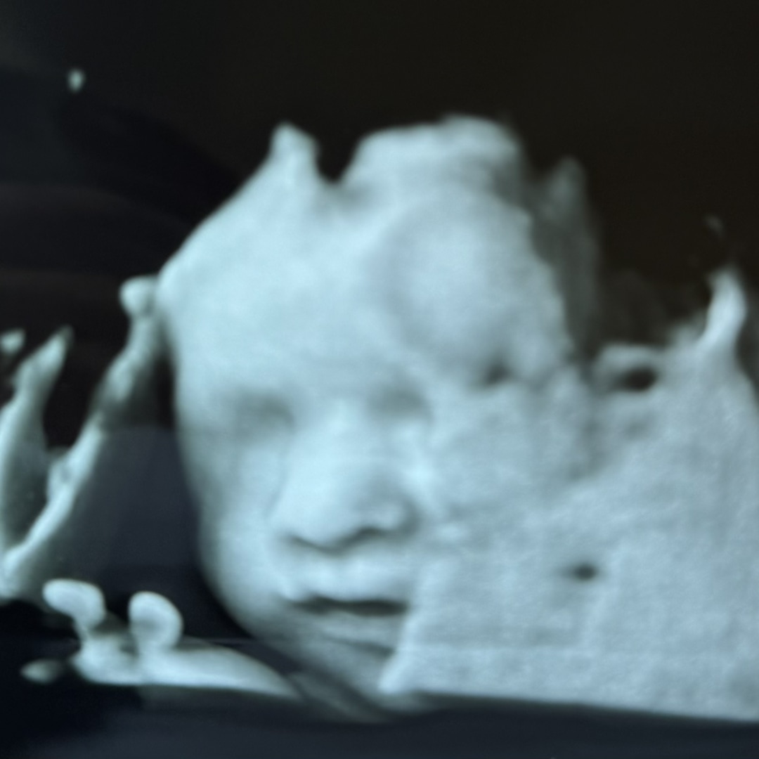 Photo shared by Alexa for their Babylist baby registry.
