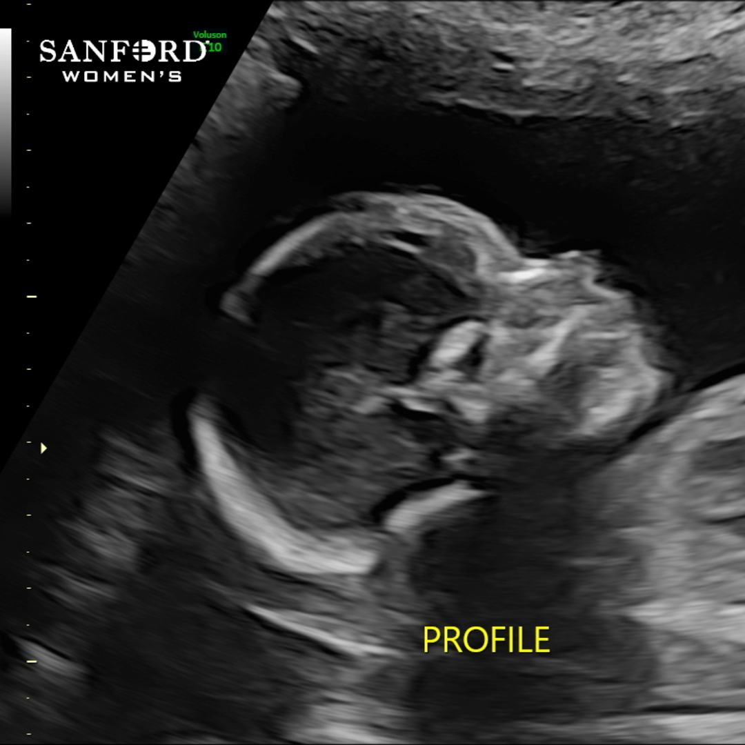 Photo shared by Hannah for their Babylist baby registry.
