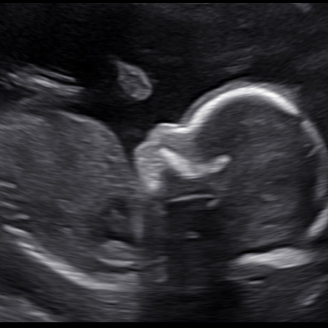 Photo shared by Jacinda for their Babylist baby registry.