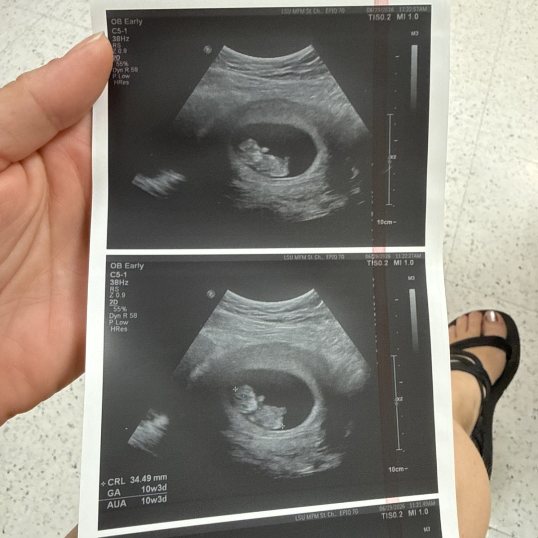 Photo shared by Allison for their Babylist baby registry.