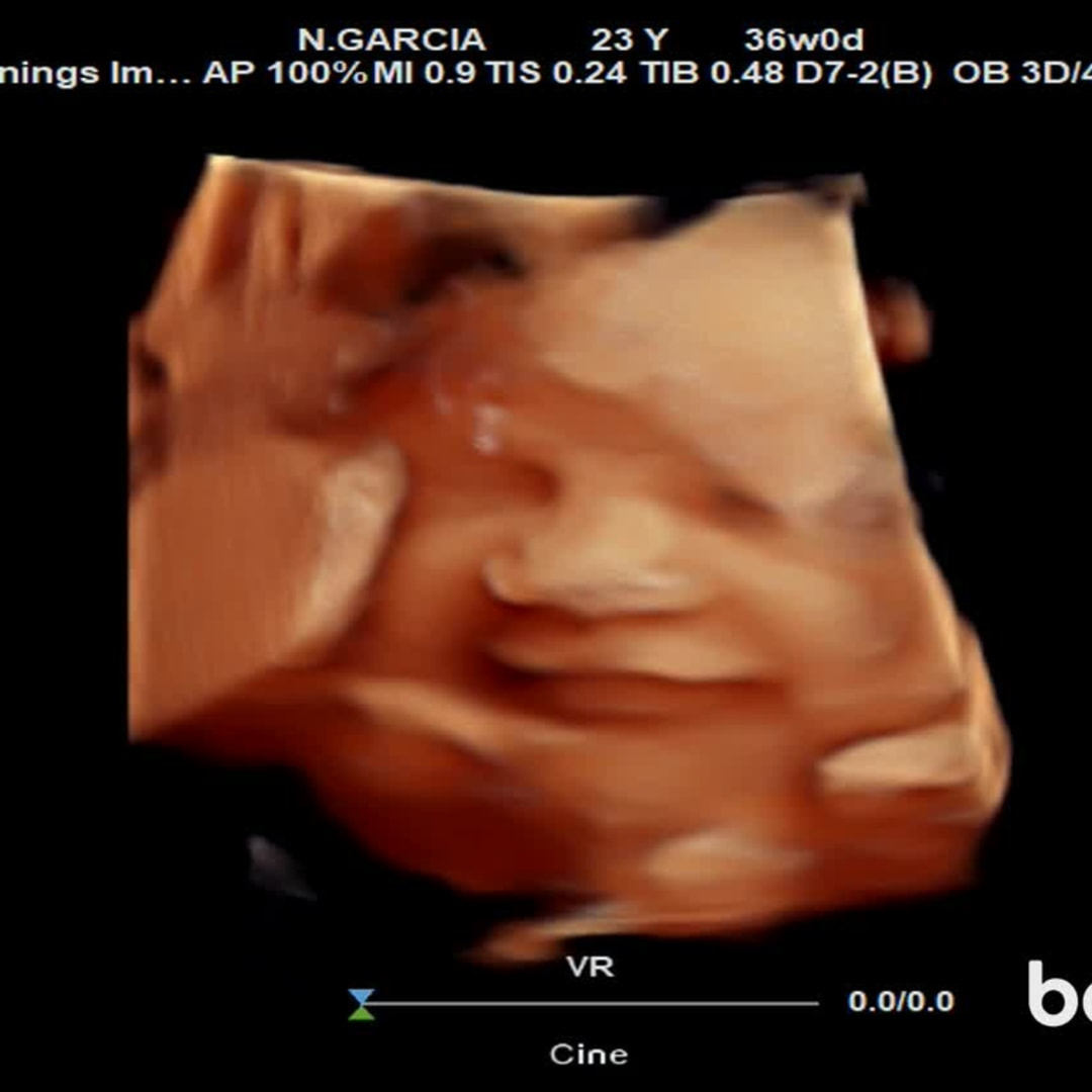 Photo shared by Natalia for their Babylist baby registry.