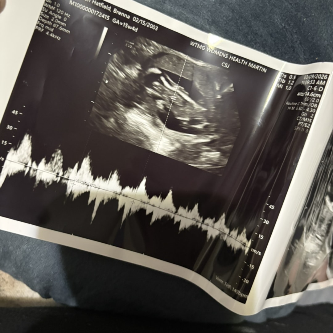 Photo shared by Brenna for their Babylist baby registry.