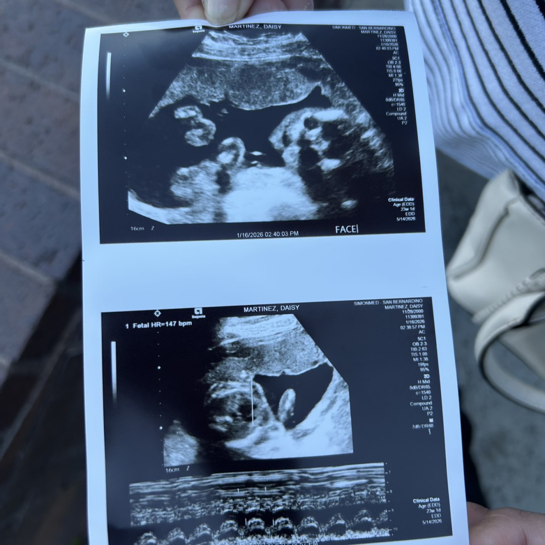 Photo shared by Daisy for their Babylist baby registry.