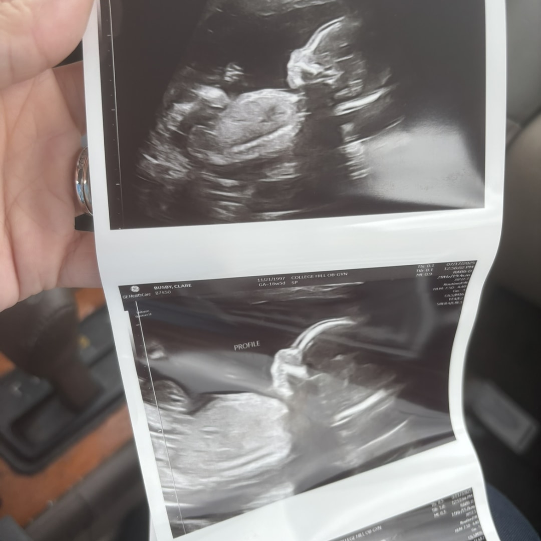 Photo shared by Clare for their Babylist baby registry.