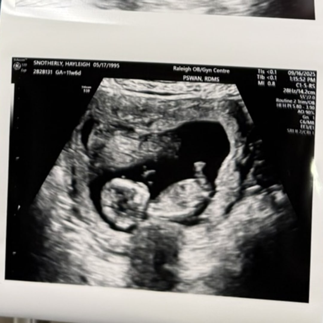 Photo shared by Hayleigh for their Babylist baby registry.