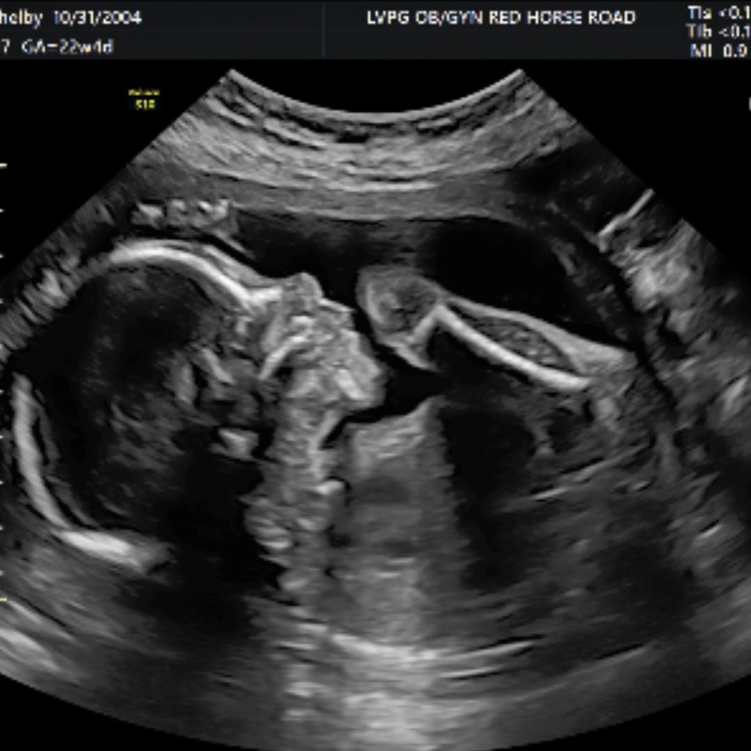 Photo shared by Shelby for their Babylist baby registry.