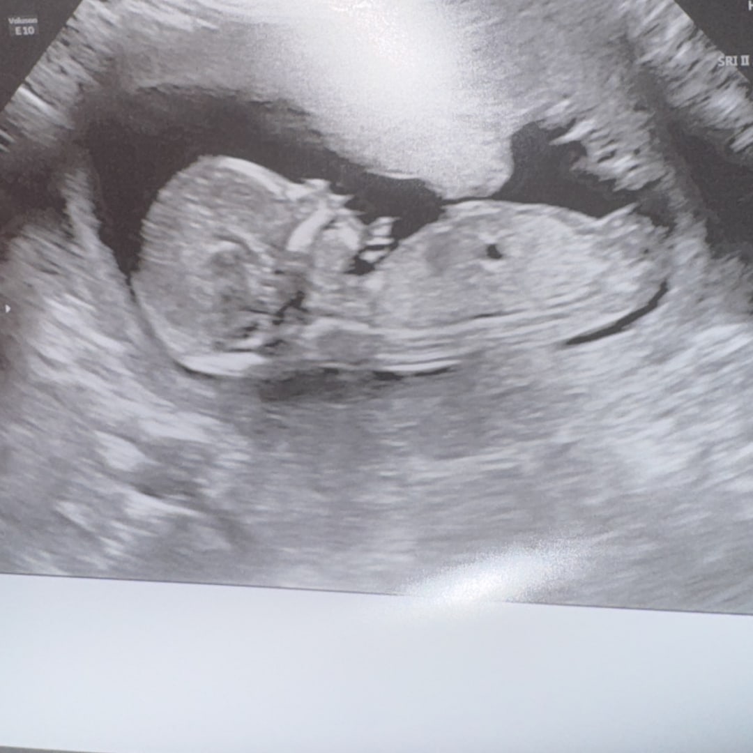 Photo shared by Makayla for their Babylist baby registry.
