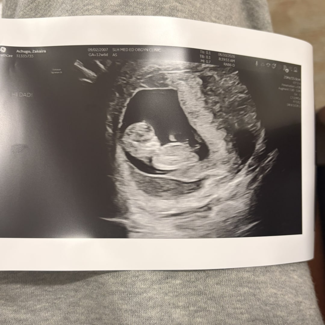 Photo shared by Chase for their Babylist baby registry.