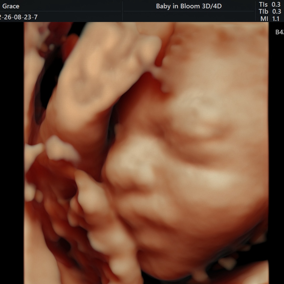 Photo shared by Grace for their Babylist baby registry.