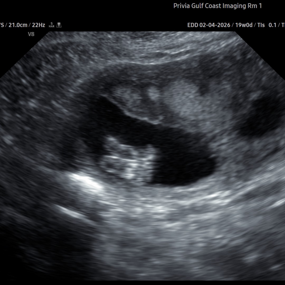 Photo shared by Presleigh for their Babylist baby registry.