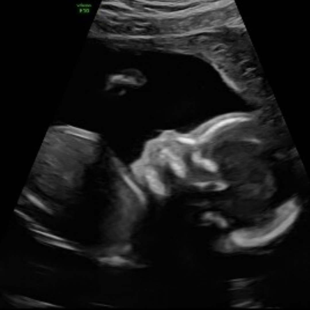 Photo shared by Lisa for their Babylist baby registry.