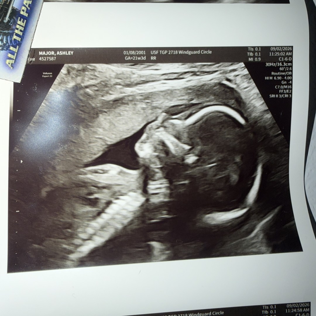 Photo shared by Chris for their Babylist baby registry.