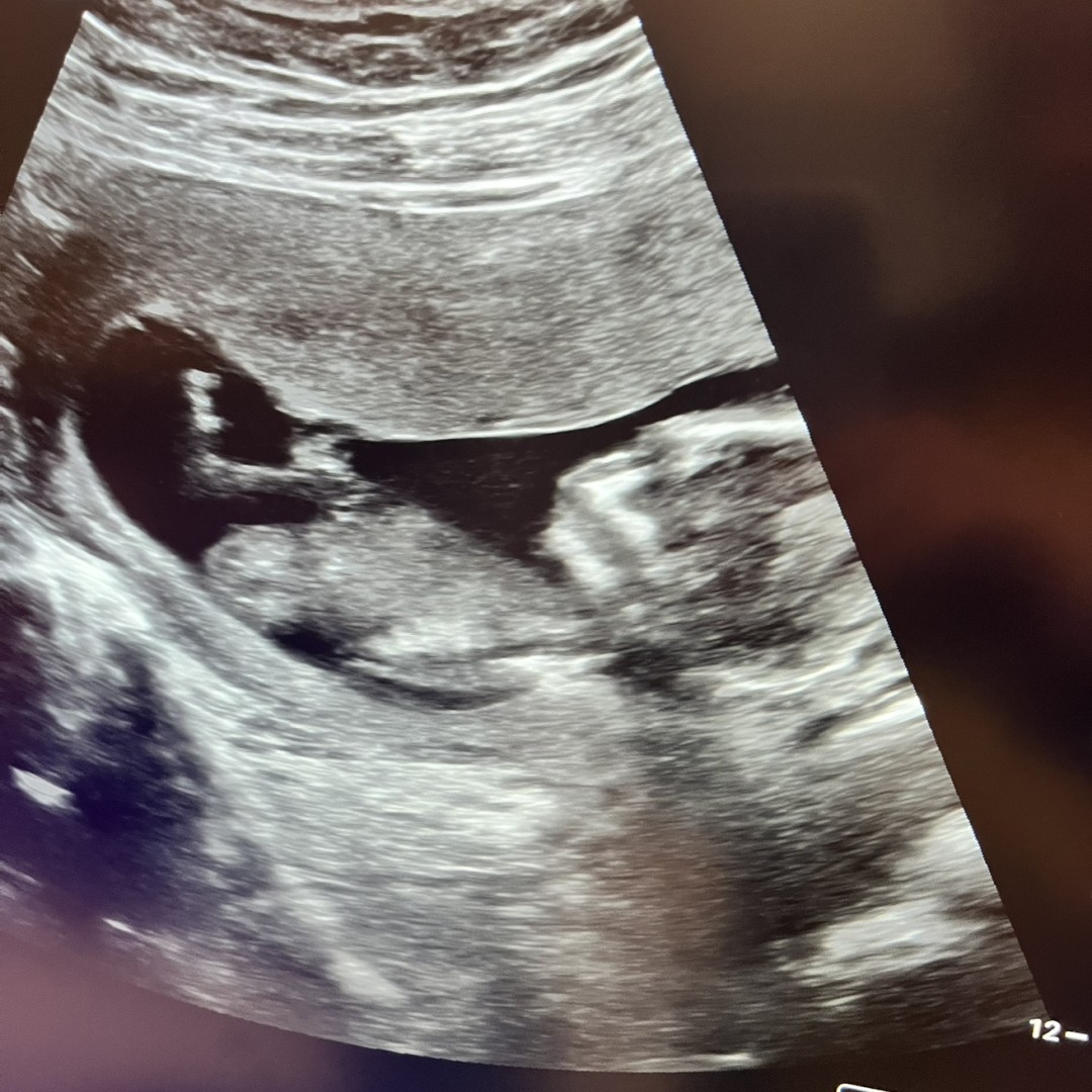 Photo shared by Emily for their Babylist baby registry.