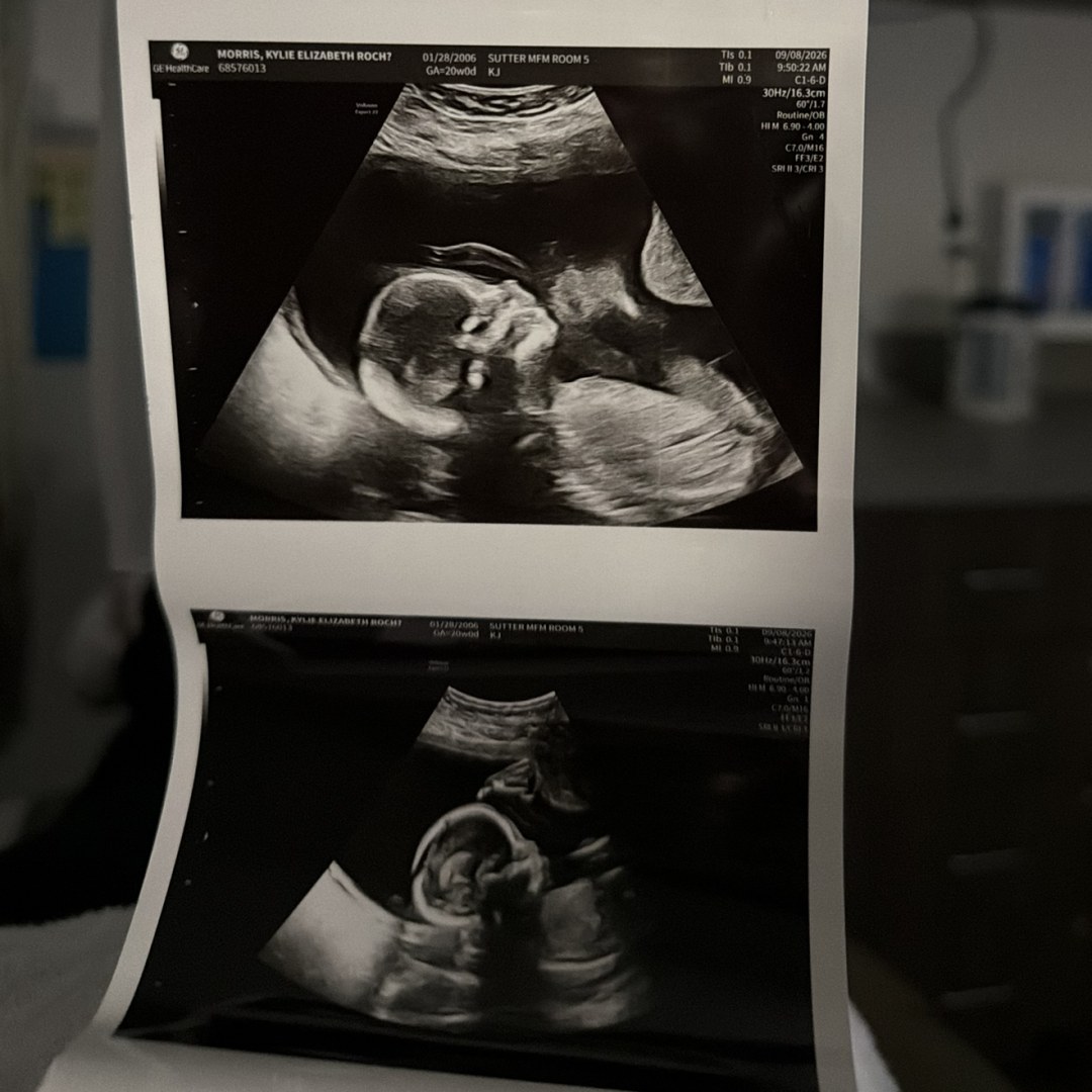 Photo shared by Kylie for their Babylist baby registry.