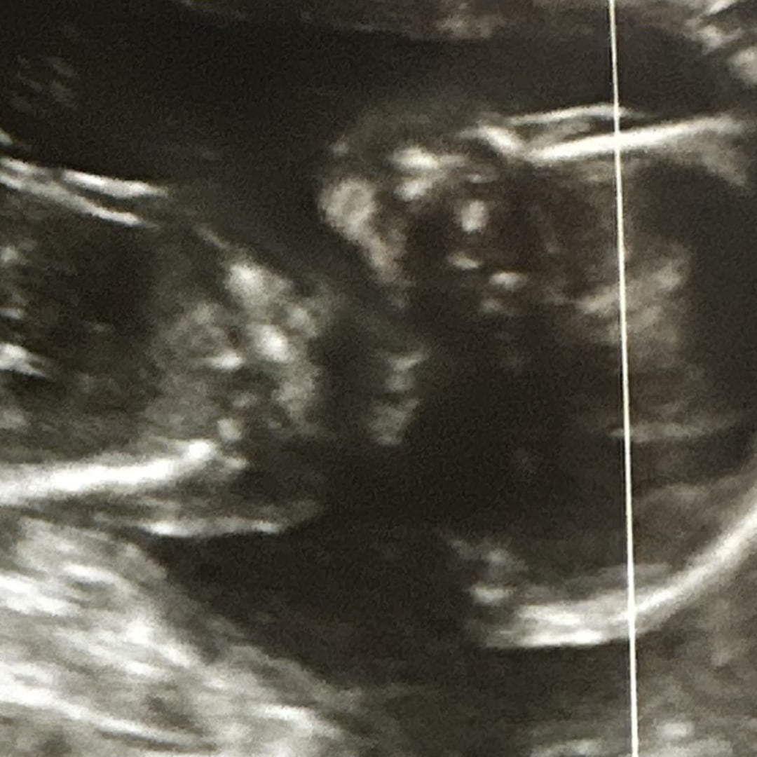 Photo shared by Meaghan for their Babylist baby registry.