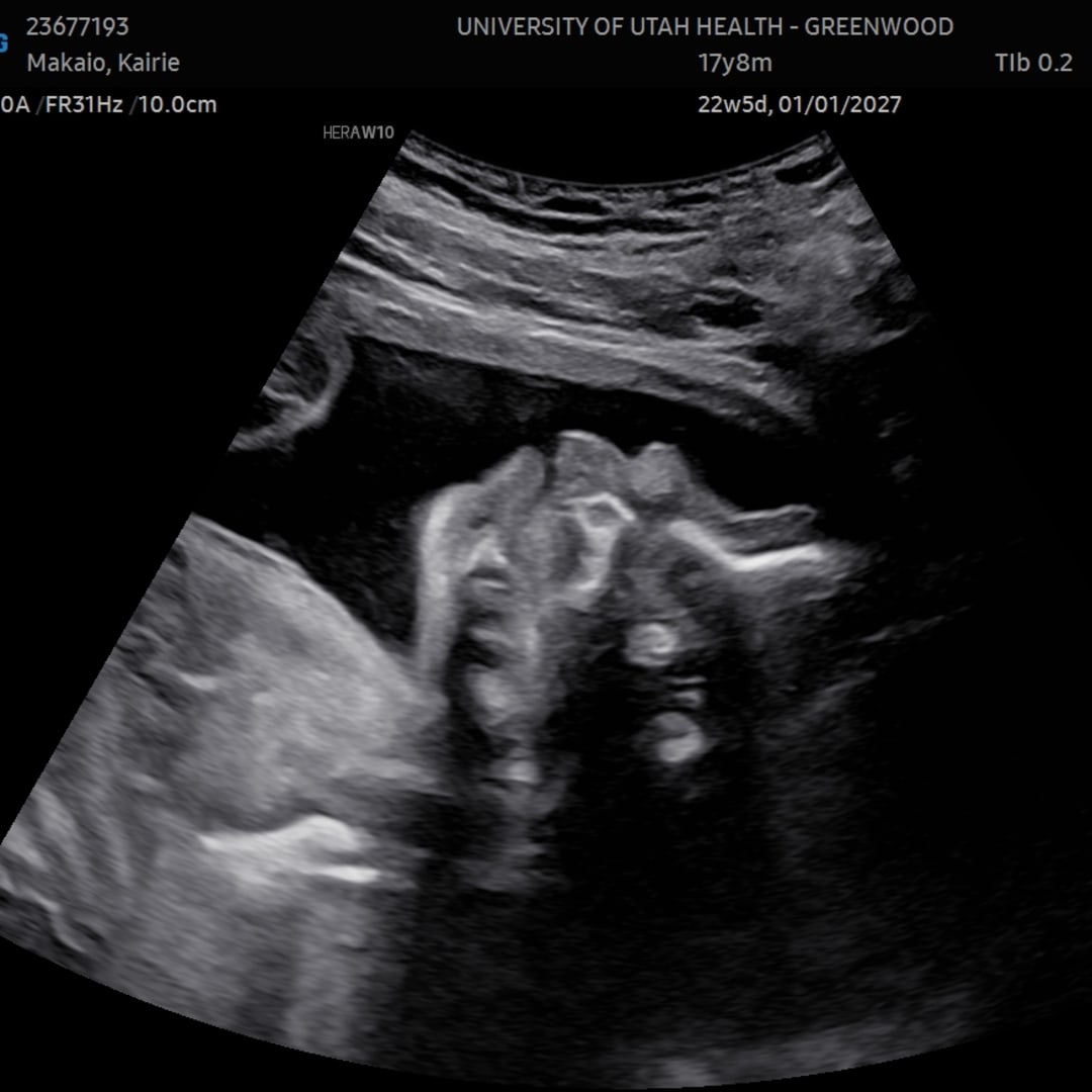 Photo shared by Kairie for their Babylist baby registry.